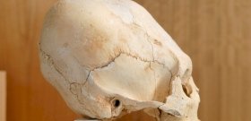 Hosszú koponyájú csontvázat találtak, amelynek csak részben emberi a DNS-e
